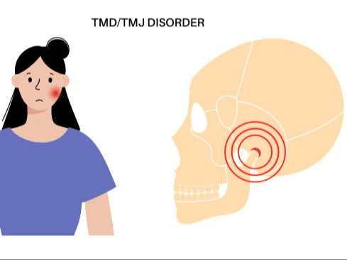 TMJ Relief: Facial Massage Workshop